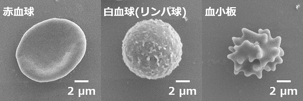 血液｜ミクロ探偵団｜ミヤマ株式会社 環境分析測定&リサーチ
